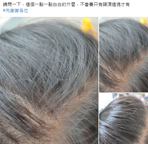 有網友求助頭髮狂冒白點的擾人問題。（圖／翻攝自臉書社團《爆系知識家》）
