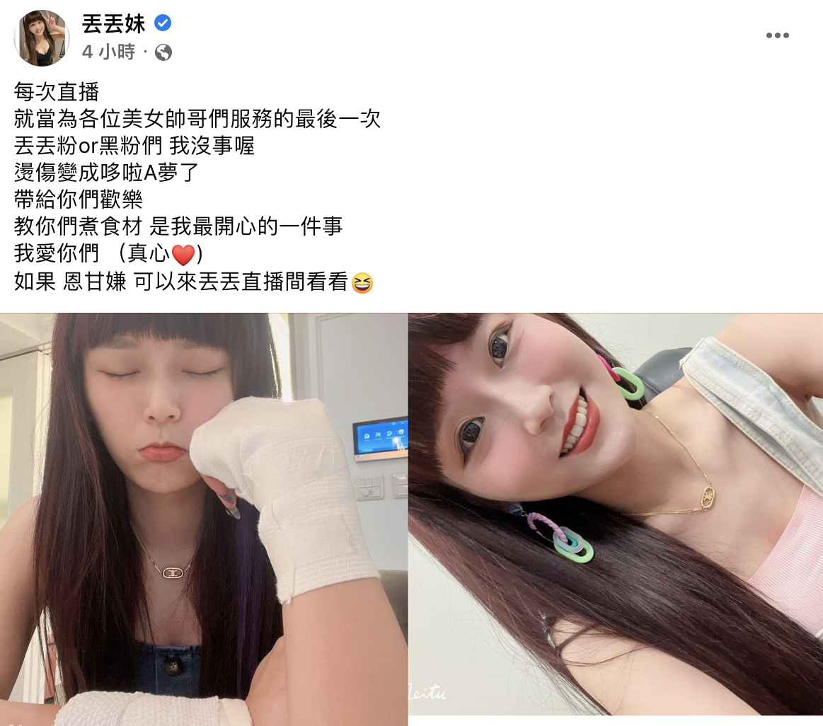 丟丟妹曝光自己傷勢，同時留言處表達自己有去就醫。（圖／翻攝自丟丟妹臉書）