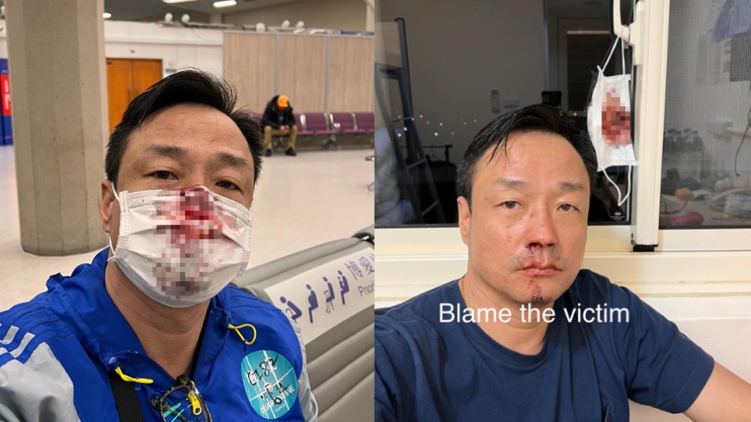 PCR被「戳鼻爆血」拒關心 王喜轟莊人祥:不知道你誰