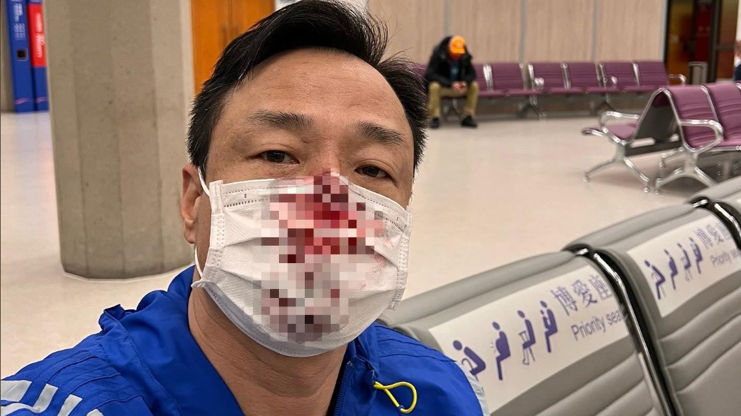 打臉王喜!護理師駁「拿廁紙止血」 私訊對話還原真相