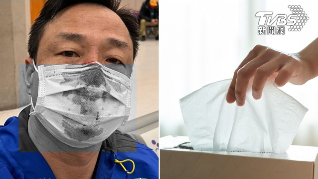 王喜流血事件「衛生紙成焦點」!港台兩地用法竟有差