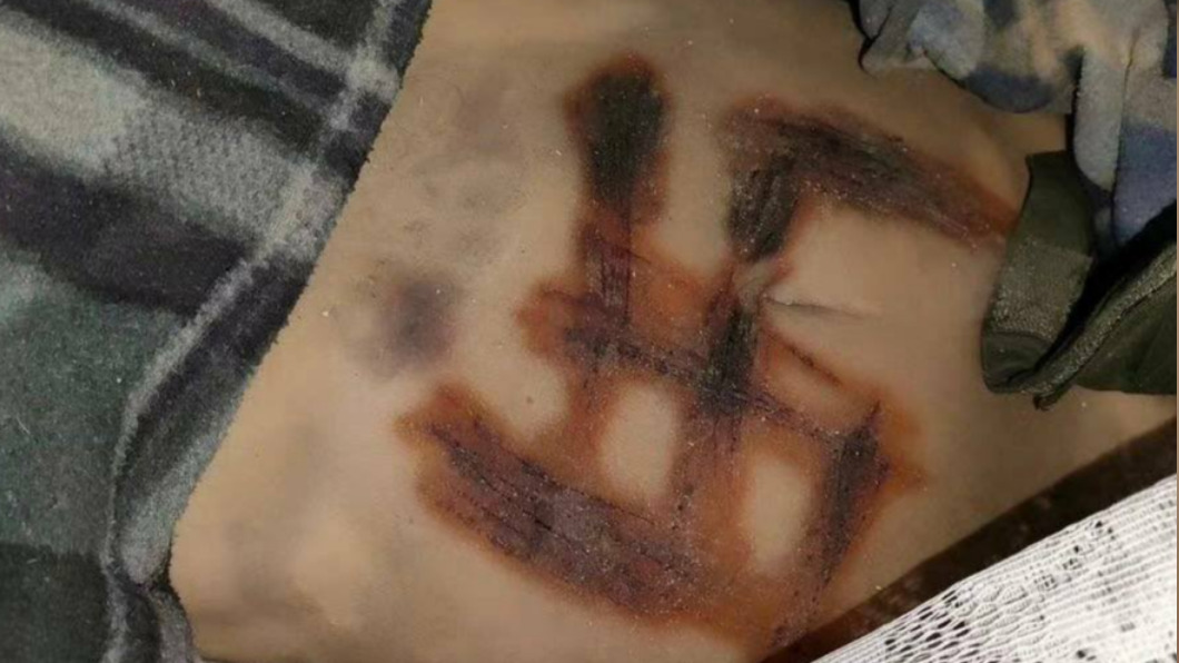 烏克蘭女屍身現「詭異卍字」!傳遭俄軍虐殺烙上 原因曝