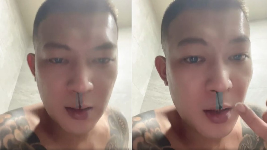 鳳梨生病操倒了!「鼻血狂噴止不住」染紅衛生紙 找不到病因