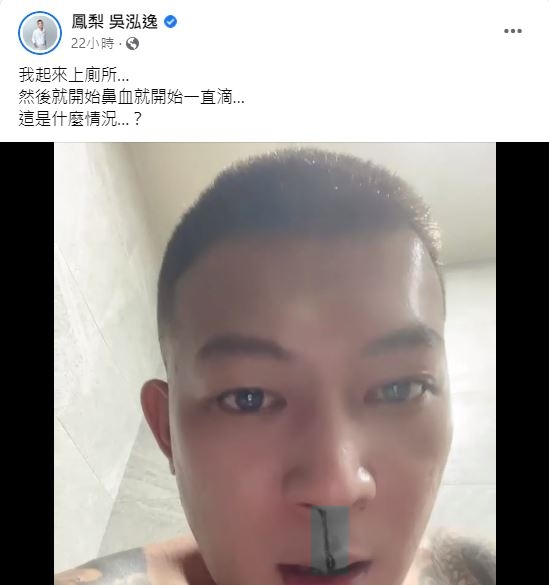 鳳梨也不知道為何自己流血。(圖/翻攝自鳳梨 吳泓逸臉書)