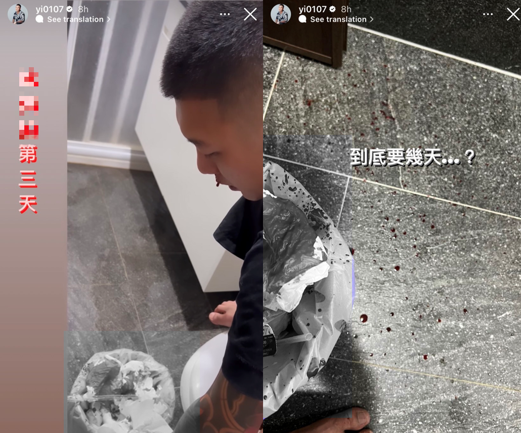 鳳梨已經連續3日狂流鼻血。(圖/翻攝自鳳梨臉書)