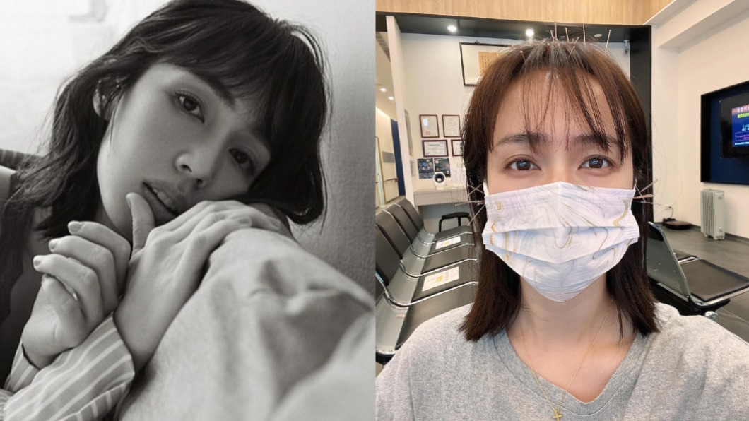 隱疾33年未解!金鐘女配「針灸插滿頭」連吞5顆止痛藥