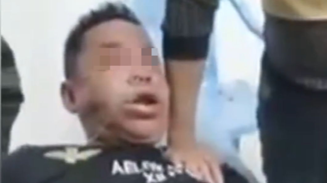 說了別弄!手癢男把玩青竹絲 下秒「腫成豬頭」痛苦倒地