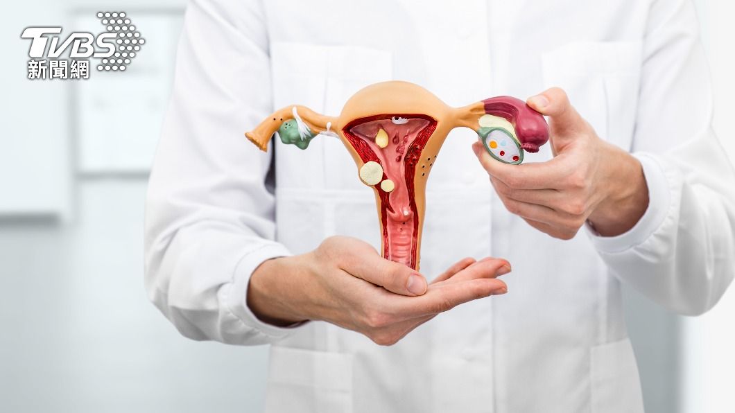 女性朋友注意!專家授飲食重點 預防乳癌、子宮頸癌
