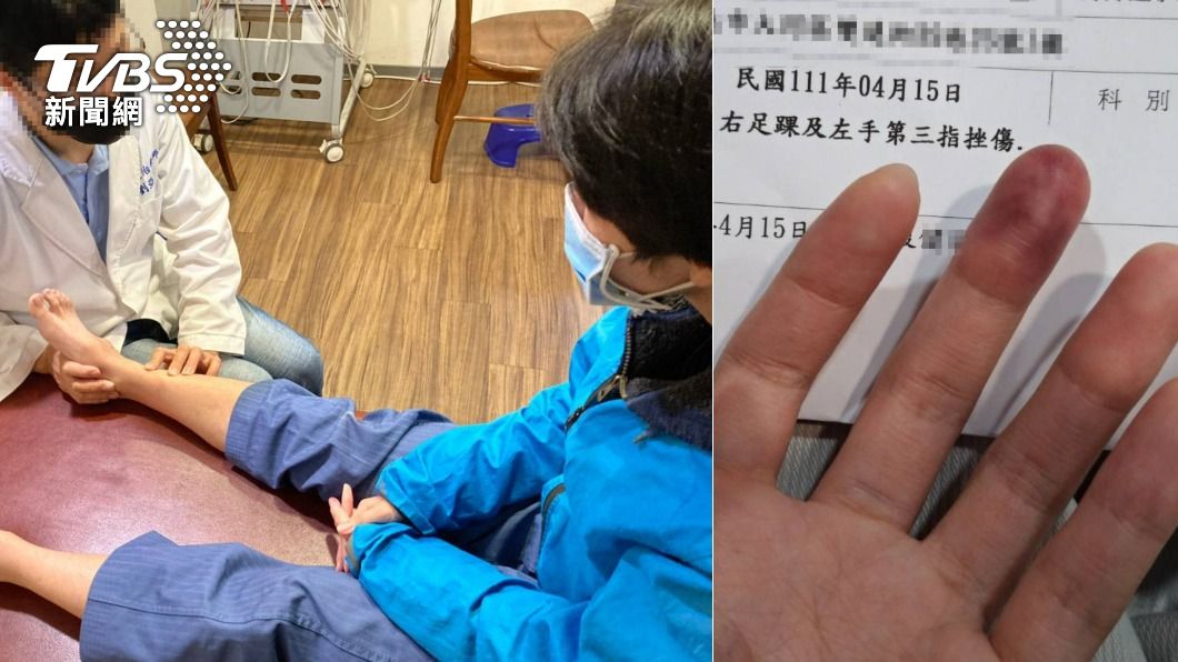 謝女的腳拐傷,手指還嚴重瘀青。(圖/當事人提供)