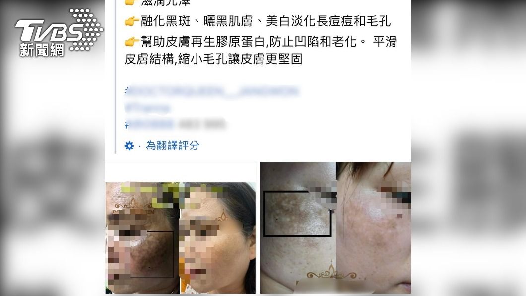 化粧品疑有宣稱療效情形。（圖／TVBS）