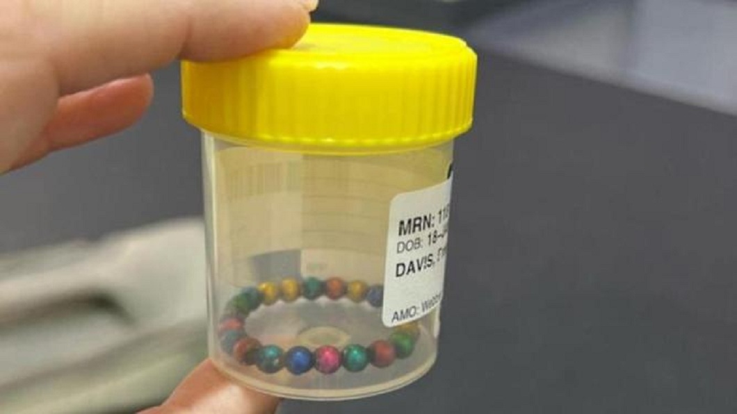 2歲娃喊肚痛「以為小病」 送醫驚見22顆磁力珠