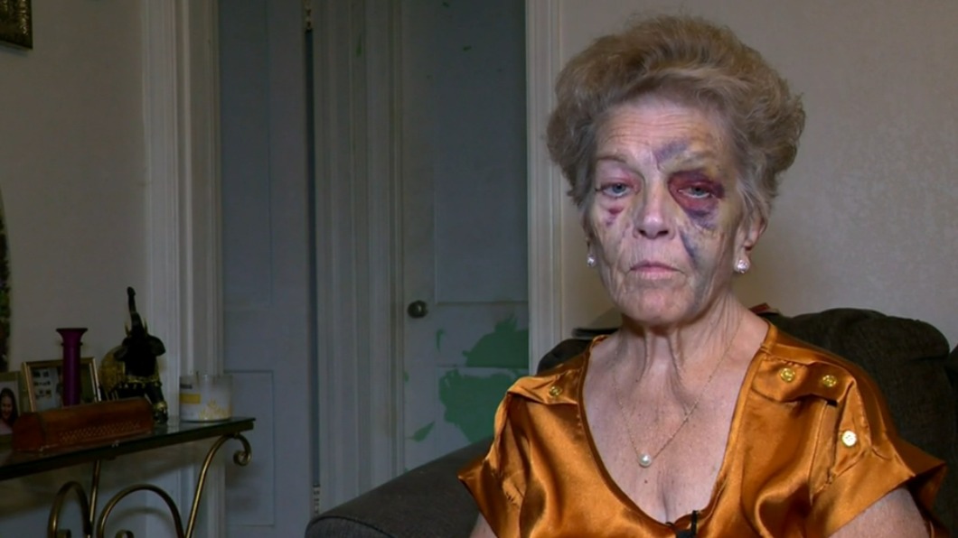現世報?美搶匪爆揍71歲阿嬤劫車 逃逸後火速遭撞亡