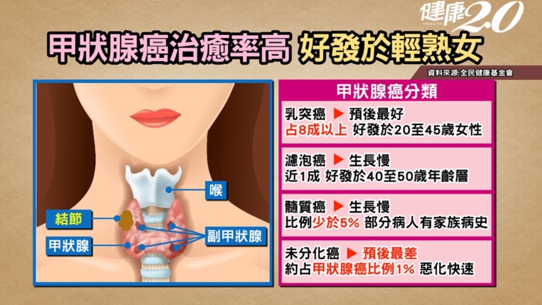 甲狀腺癌治癒率高,好發輕熟女。(圖/翻攝自健康2.0)
