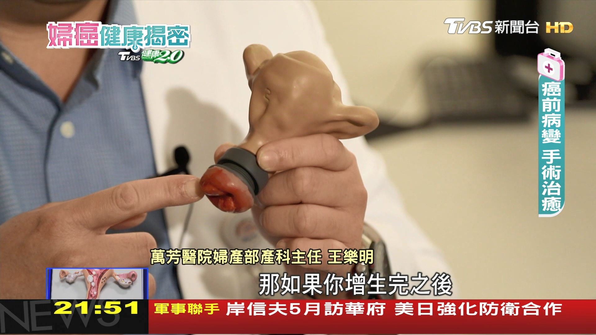 圖／TVBS