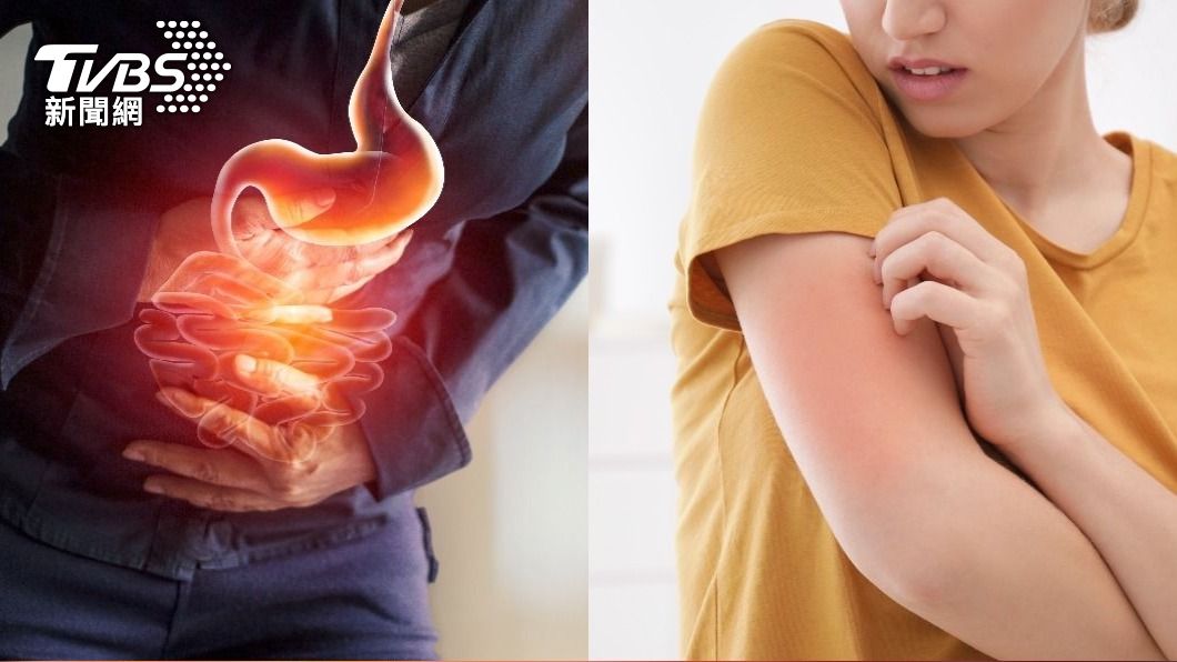 喝牛奶肚子痛≠過敏！6症狀當心食物不耐受　專家揭真相