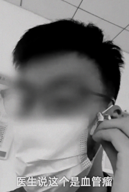男子摳破痘痘,鮮血直流。(圖/翻攝自微博)