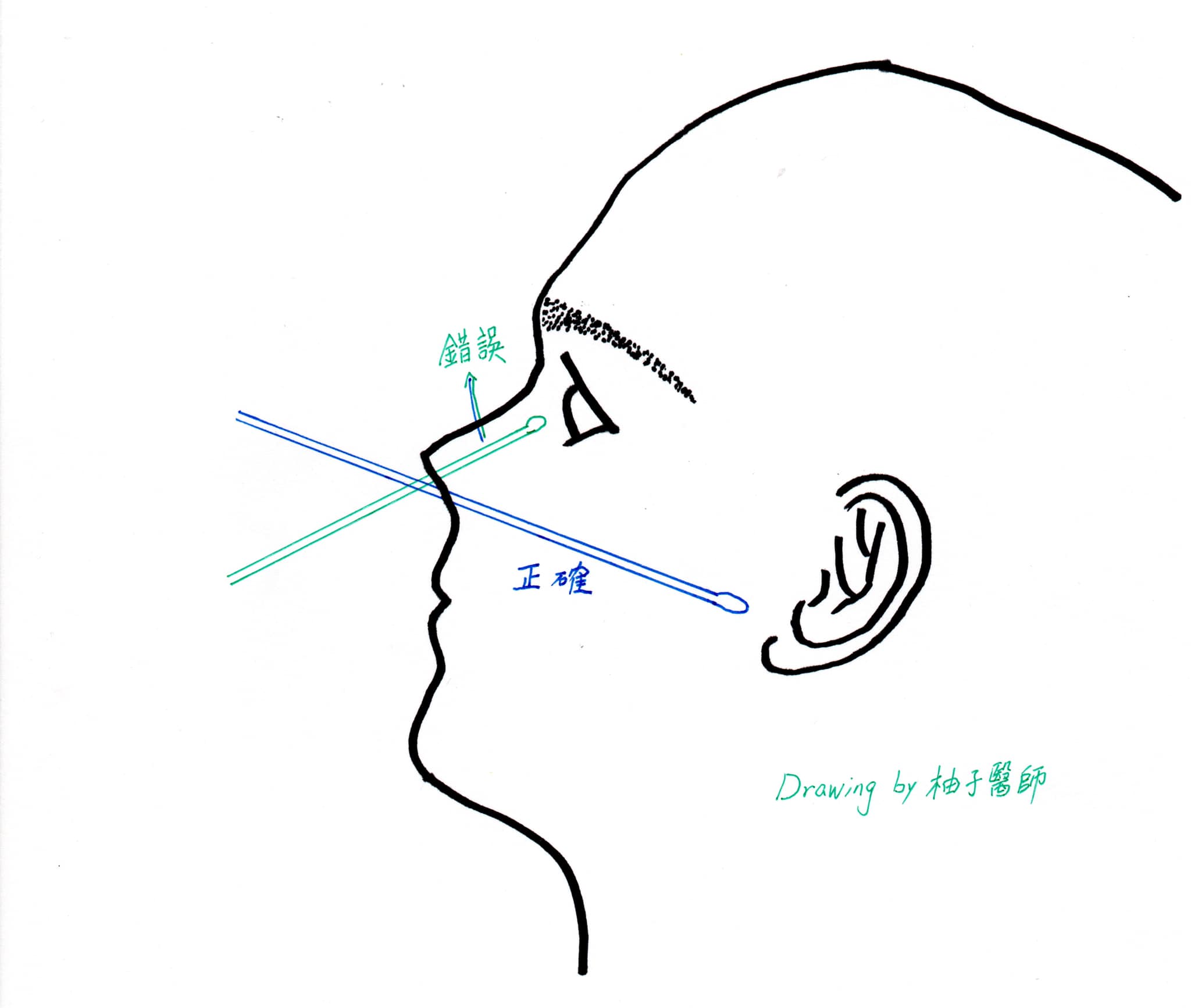快篩正確方式。(圖/翻攝自柚子醫師的育兒診療室 - Dr.陳木榮醫師臉書)