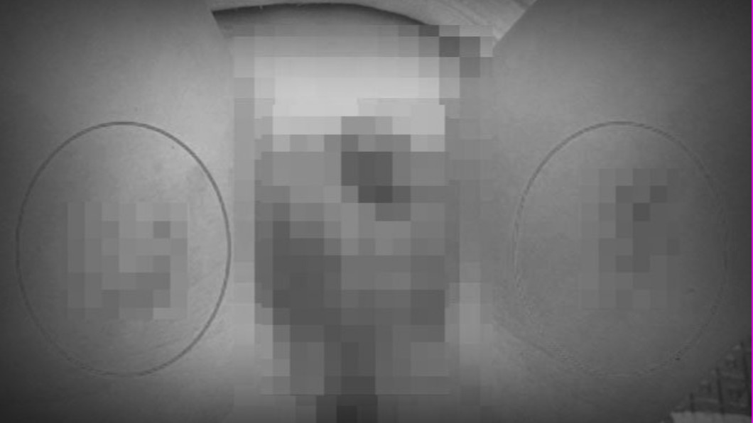 男童下體有多處傷痕。（圖／翻攝自記者爆料網）