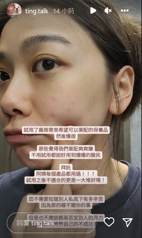 邵庭公開「爛臉照」回擊酸民。(圖/翻攝自ting.talk IG)