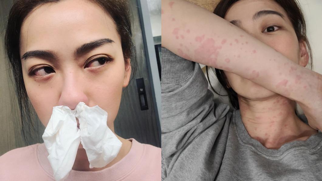 電商女帝怒了!被嗆業配爽賺 公開「爛臉照」訴背後辛酸