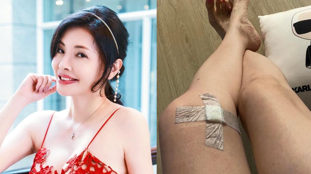 何如芸下戲突然「蹲不了」!醫評估這原因、2動作護膝