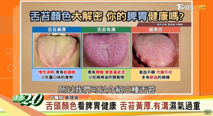 有3種舌苔的顏色要注意。(圖/TVBS)
