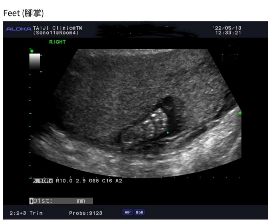 腹中胎兒很健康。(圖/翻攝自陳伶宣臉書)