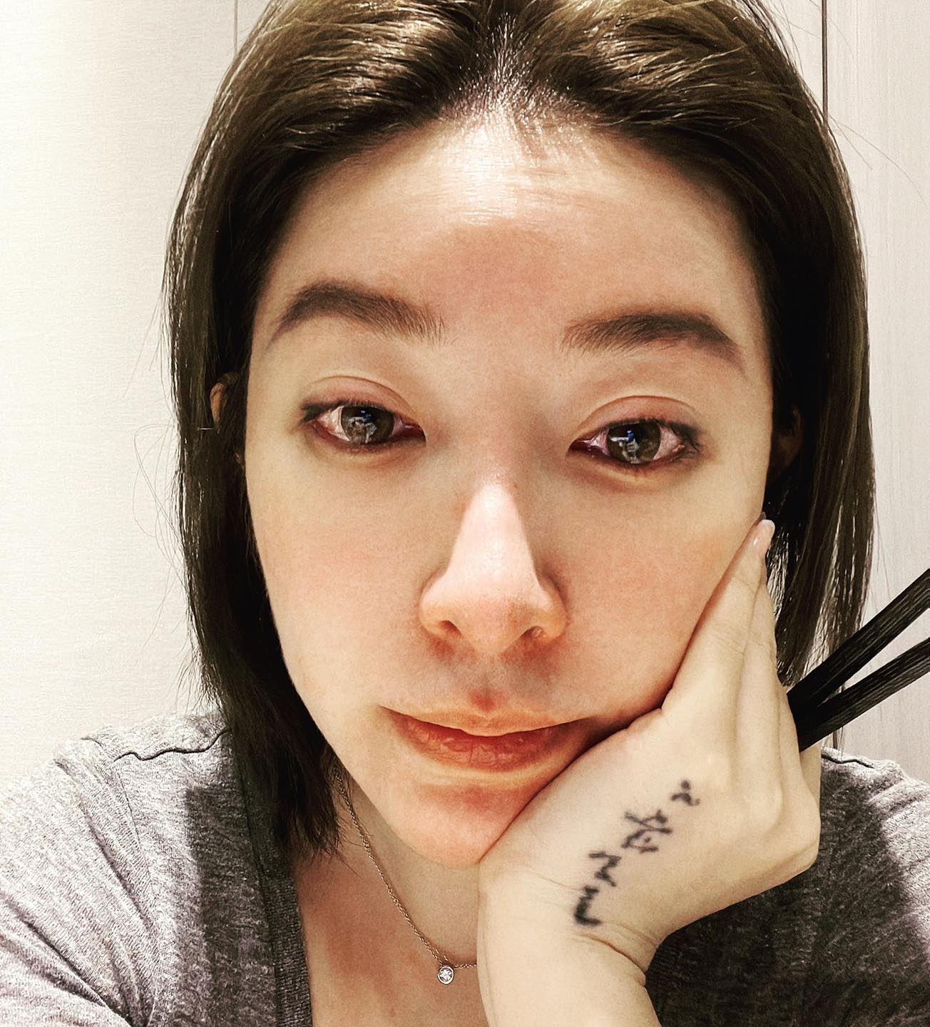 許維恩被迫中止取卵手術，貼出含淚照片引發心疼。（圖／翻攝自許維恩臉書）