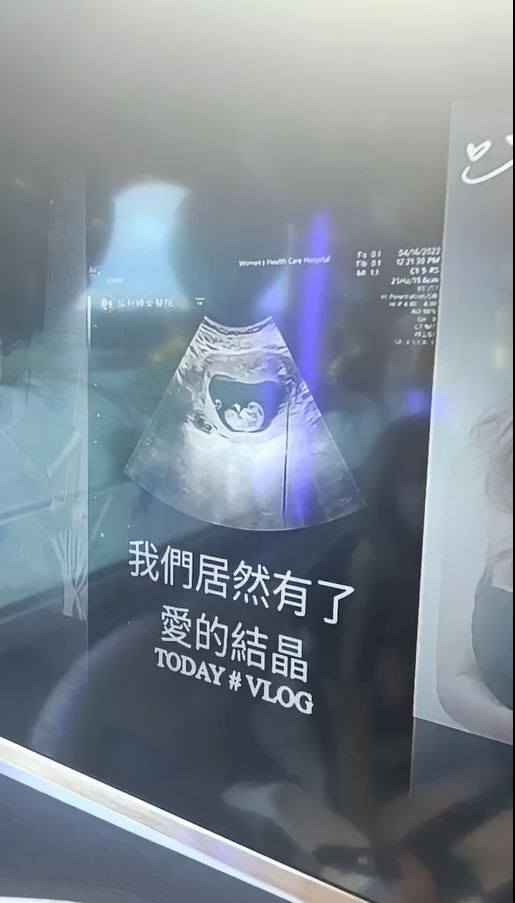 Makiyo的超音波照。(圖/翻攝自Makiyo臉書)