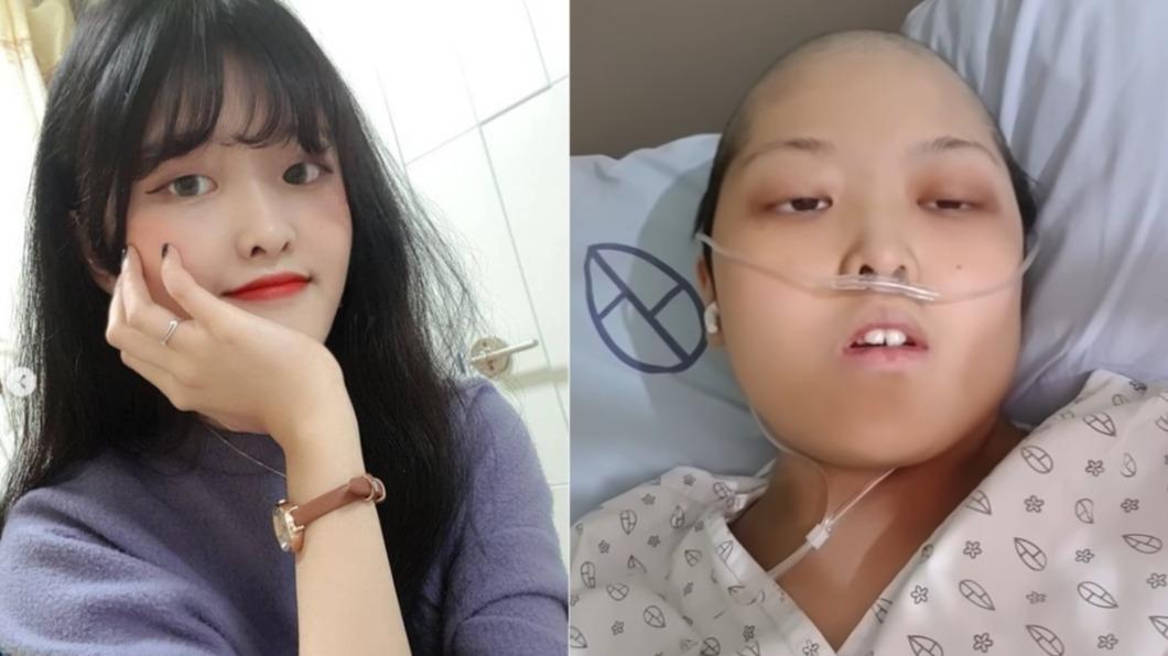 21歲網紅「癌末猝逝」！發現時已沒救　臨終遺言曝光