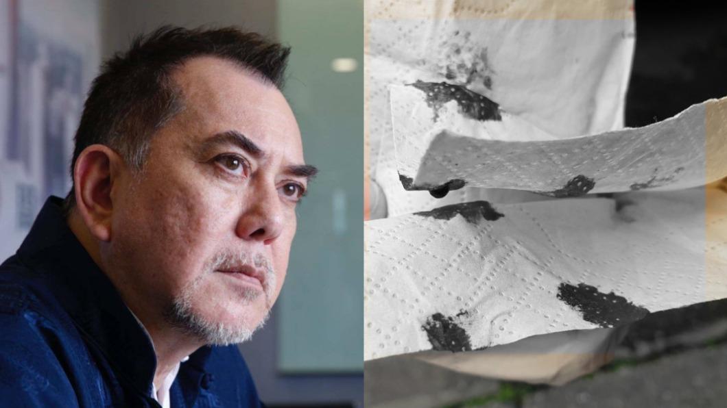 黃秋生爆血！在台PCR被戳傷　下秒「驚人反應」急緩頰