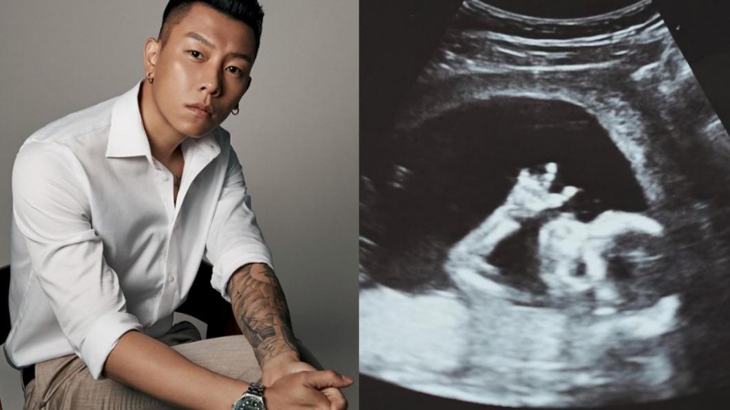 恭喜!瘦子才剛宣布結婚 喜曬超音波照「證實當爸」