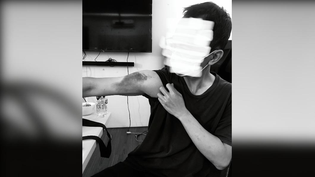 博弈業徵才為餌 台灣男子抵菲律賓遭毆打、誣稱欠債