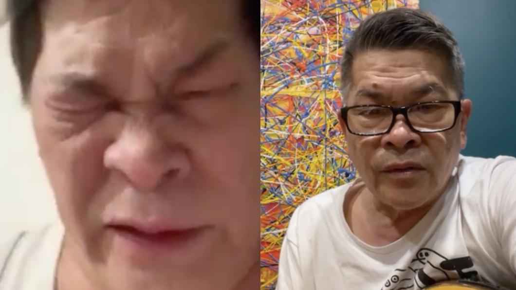 澎恰恰「腳掌反折」傷勢曝光! 冒整頭白髮:2隻腳不是我的