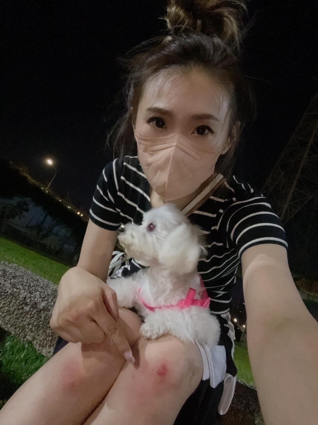 謝金晶為了保護愛犬受傷。(圖/翻攝自謝金晶臉書)