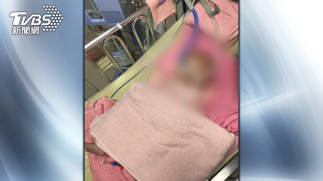 嬰腦出血醫通報受虐　父母錯愕：很疼愛