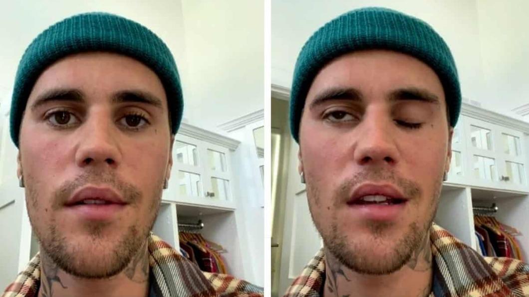 小賈斯汀Justin Bieber罹病 巡演喊卡、面癱影片曝