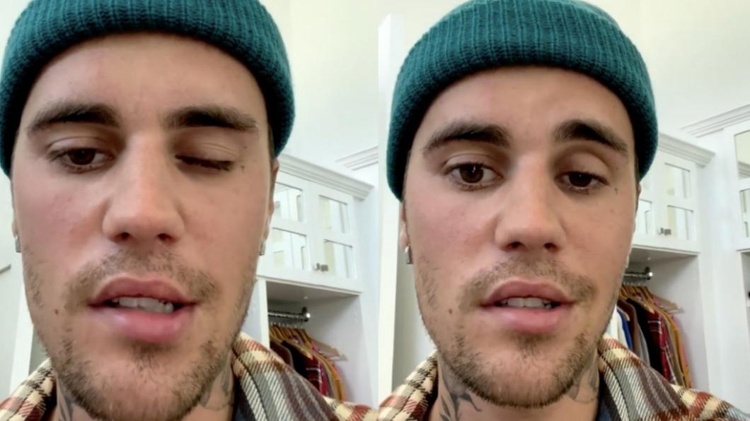 小賈斯汀眼睛會不自覺眨起來。(圖/翻攝自Justin Bieber IG)