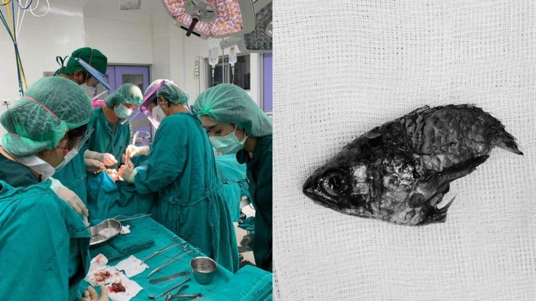 逆襲!泰國漁夫海上張嘴 遭長刺飛魚插喉嚨險窒息