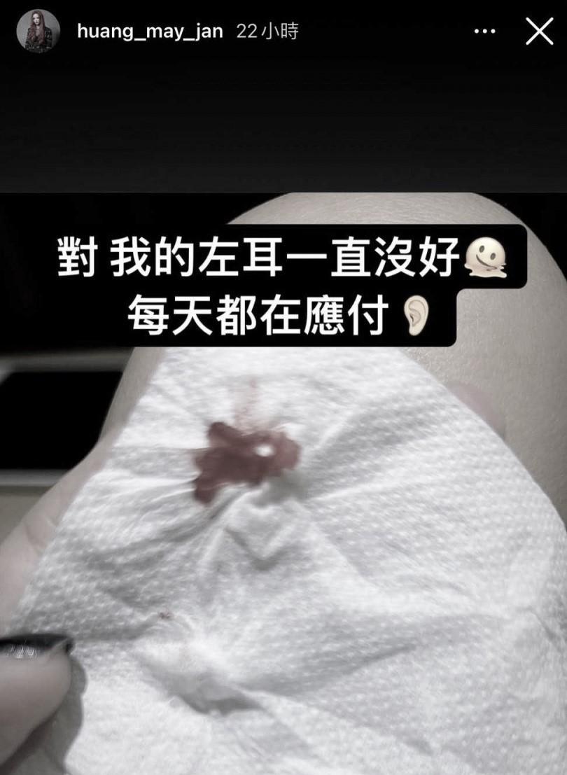 黃美珍的耳朵至今仍會流血流膿。（圖／翻攝自黃美珍IG）