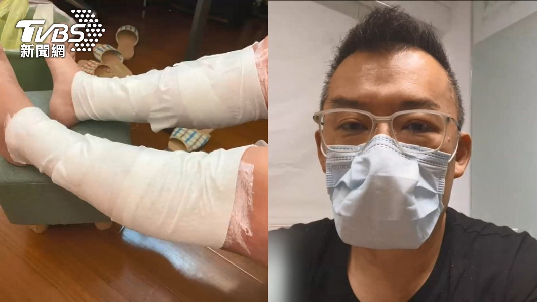 殺菌燈燙傷雙腿、角膜！家電達人5避雷撇步：這功能優先考慮