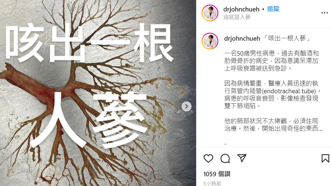 醫師分享罕見案例。(圖/翻攝自IG@drjohnchueh)