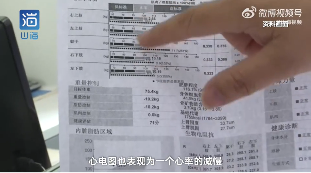 女患者體重只剩25公斤。(圖/翻攝自微博)