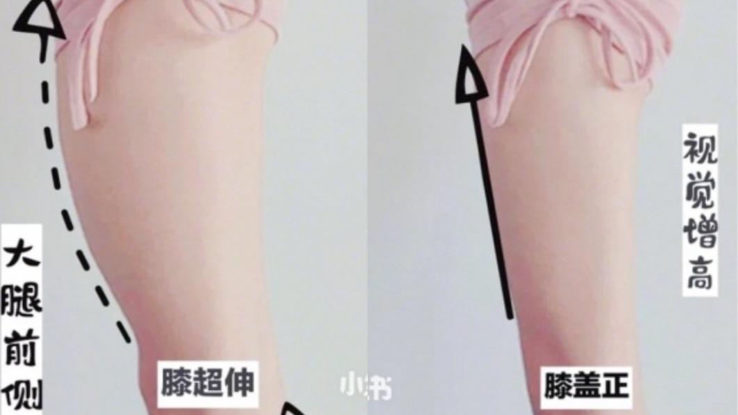 瘦不了！大腿前側突出　專家：剷平靠「5動作」拉伸