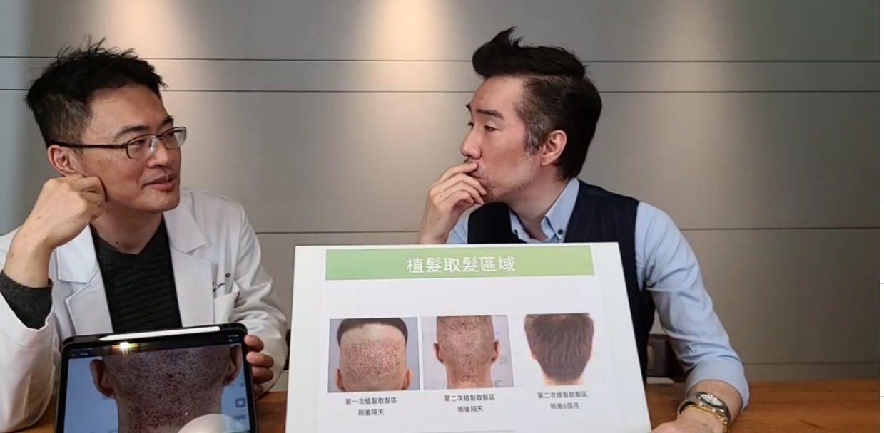 張兆志植髮過程,後腦勺頭皮都是血洞。(圖/翻攝自張兆志臉書)