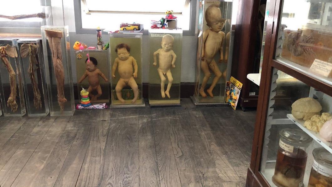 館內保存連體嬰、早夭嬰及罕見疾病過世的民眾等遺體。(圖/翻攝自th.tripadvisor.com)