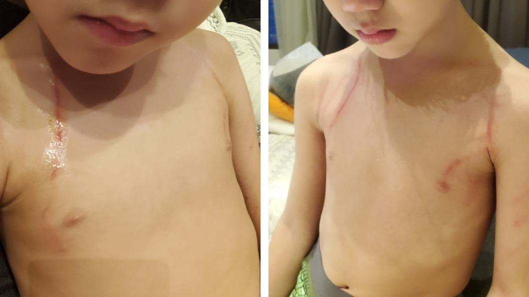 陳仙梅貼出兒子們打得傷痕累累的照片。(圖/翻攝自陳仙梅臉書)