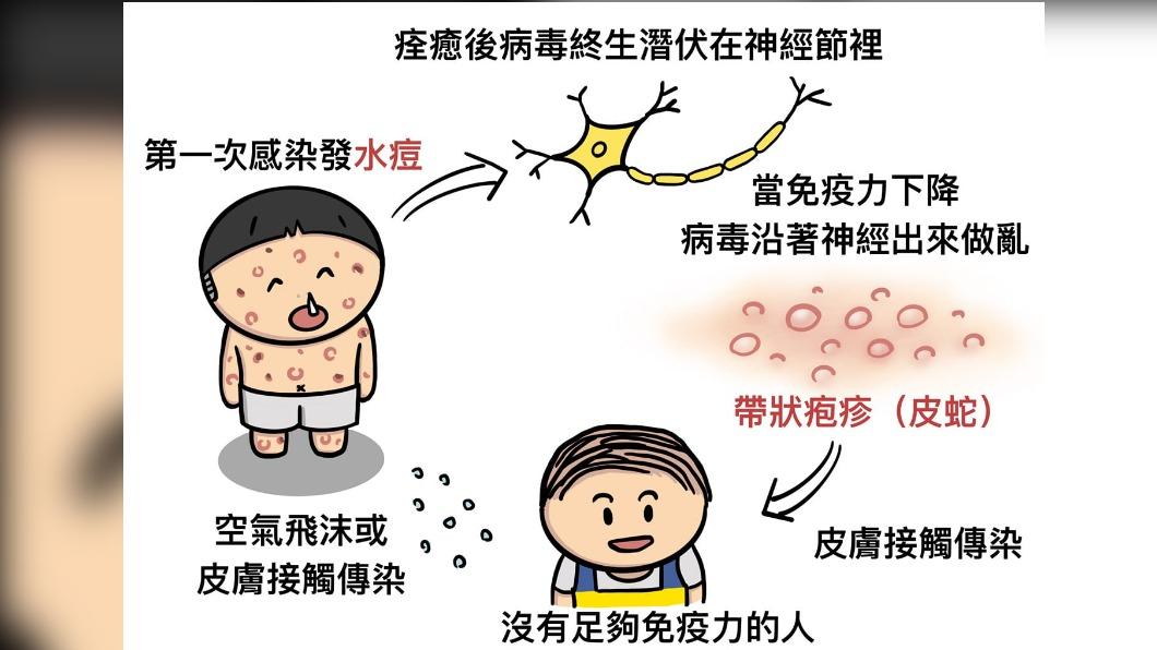 醫師解釋水痘傳染途徑。(圖/翻攝自陳敬倫臉書)