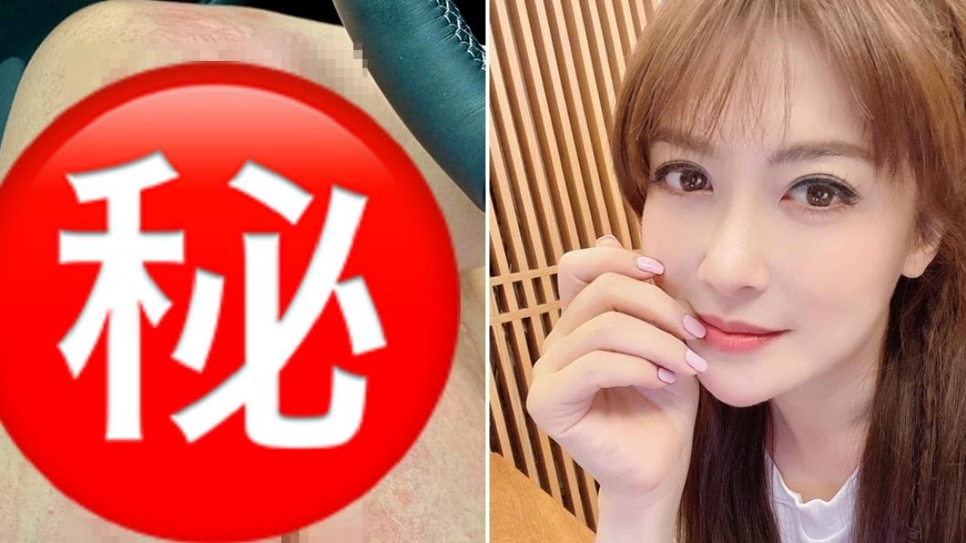 美女主播蕁麻疹發作！癢到「呼吸困難」　患部照嚇壞粉絲