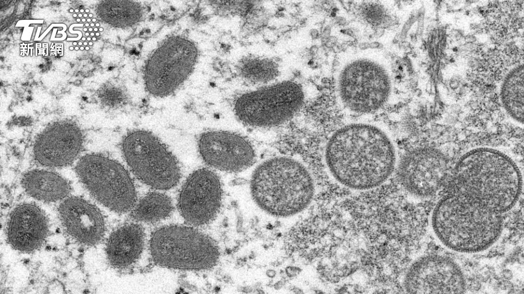 WHO:猴痘持續傳播 恐進入孕婦兒童高危族群